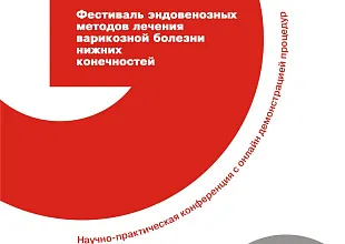 Фестиваль эндовенозных методов лечения варикозной болезни нижних конечностей